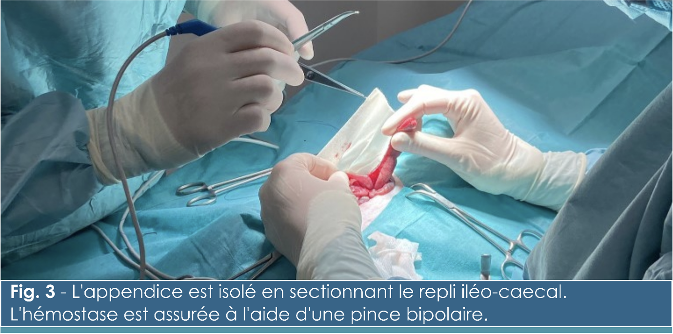 Chirurgie-Appendicite chez un lapin